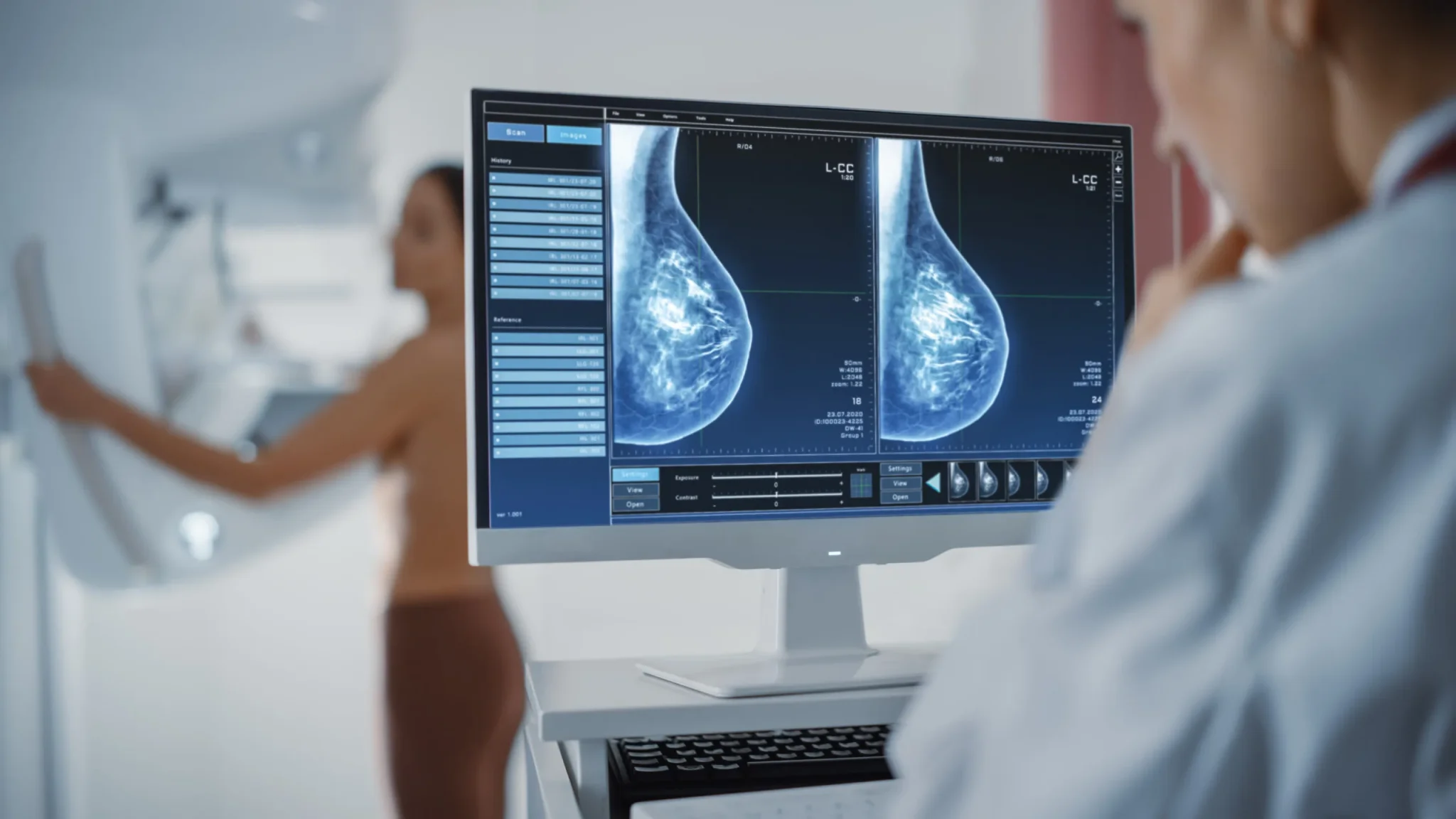 3D Mammography